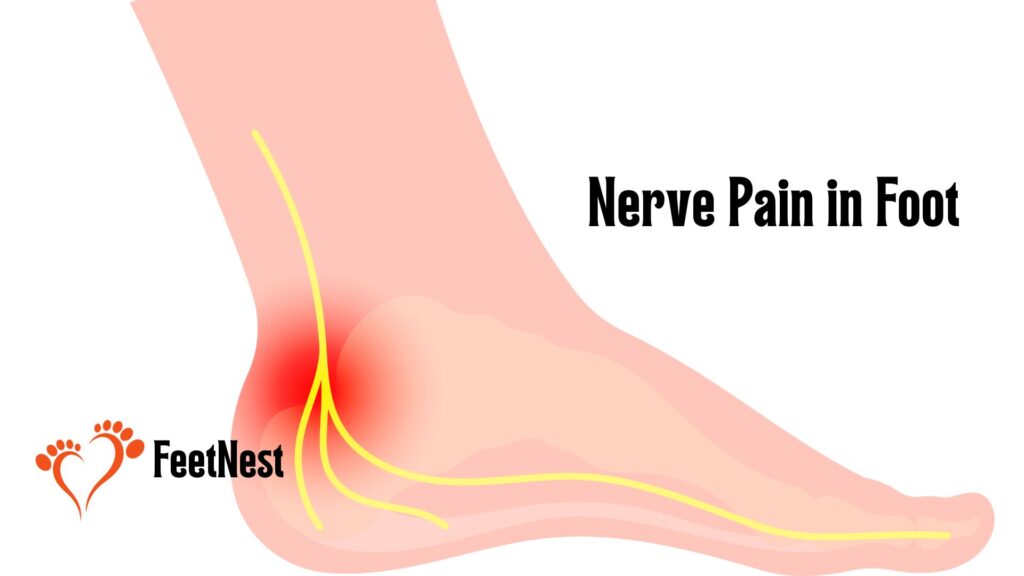 nerve-pain-in-foot